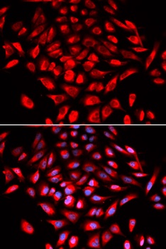 CAMK4 Antibody
