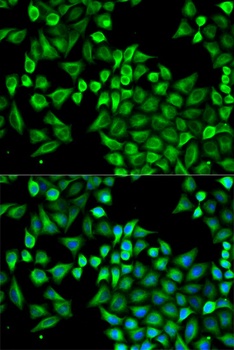 ABAT Antibody