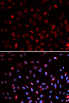 ERCC1 Antibody