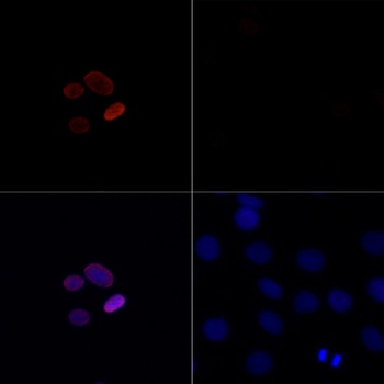 H4K16ac Antibody