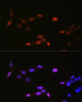 H3K14me1 Antibody