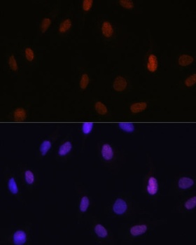 H3K14me1 Antibody