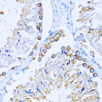 CD63 Antibody