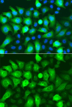 RRM2 Antibody