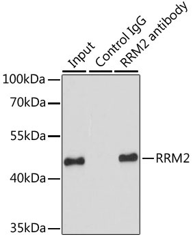 RRM2 Antibody