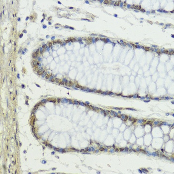 Snai1 Antibody