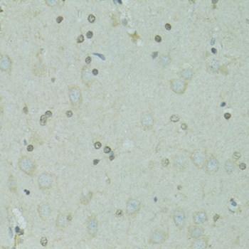 GTF2H2C Antibody