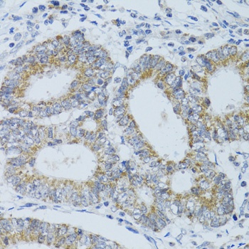 DNAJC19 Antibody