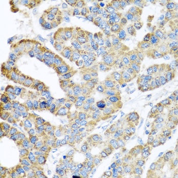 ATPIF1 Antibody