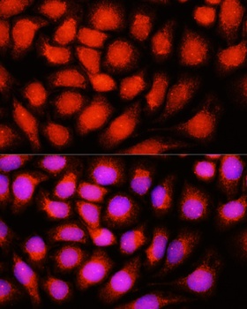 DNAJB14 Antibody