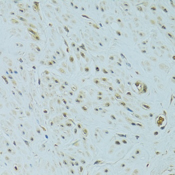 NHEJ1 Antibody