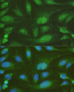 NHEJ1 Antibody