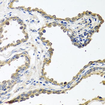 COLEC11 Antibody