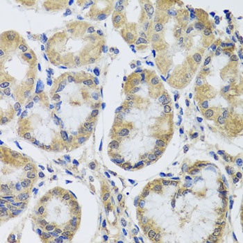 MRPL1 Antibody