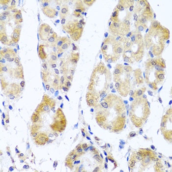 MRPL11 Antibody