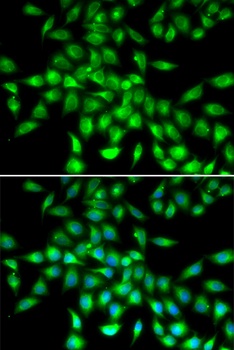 SERPINA10 Antibody