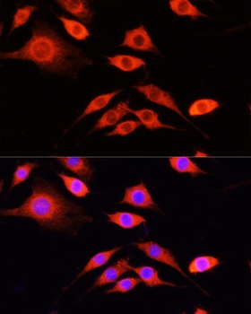 SERPINA10 Antibody