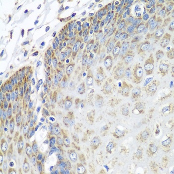 TMOD3 Antibody