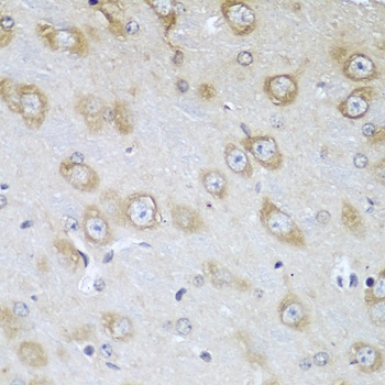 TMOD3 Antibody