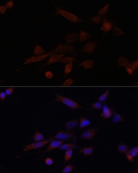 TMOD3 Antibody