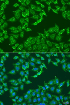 ADAP1 Antibody