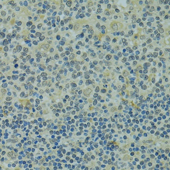 IVNS1ABP Antibody