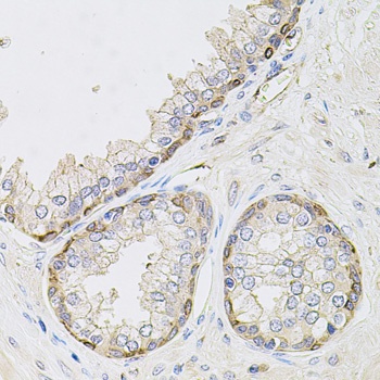 CIB1 Antibody