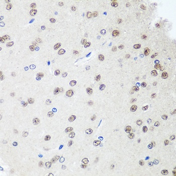 SAP18 Antibody