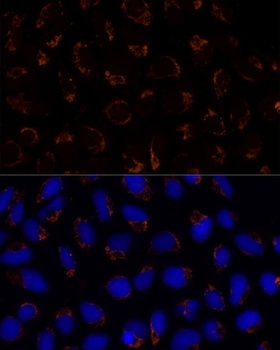 TRAP1 Antibody