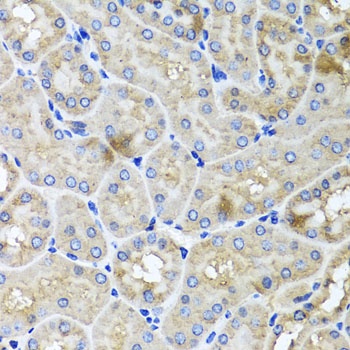 USH1C Antibody