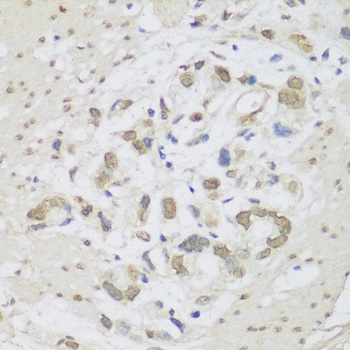 DHX38 Antibody