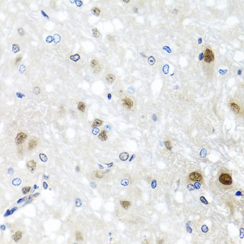 SAFB2 Antibody