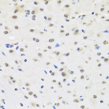 SAFB2 Antibody