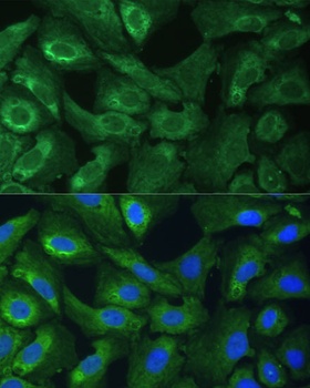 EIF3G Antibody