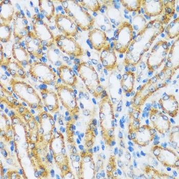 ARHGEF5 Antibody