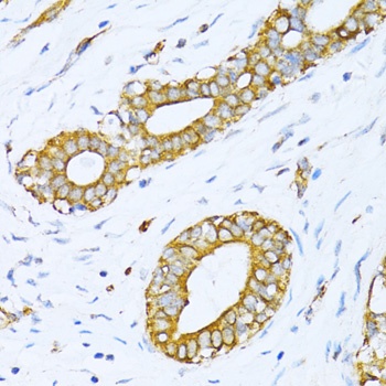 VARS Antibody