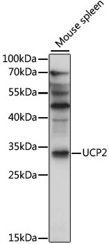 UCP2 Antibody
