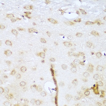 UBE2L3 Antibody