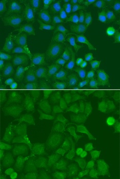 SSX5 Antibody