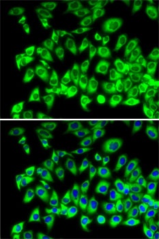 RPL13 Antibody