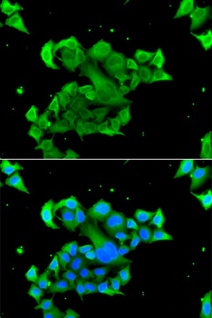 Rad51D Antibody