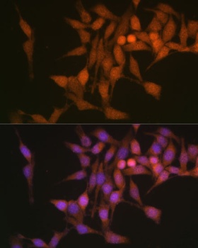 PSMB6 Antibody