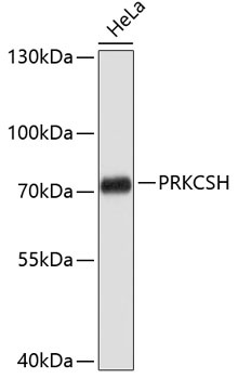 PRKCSH Antibody