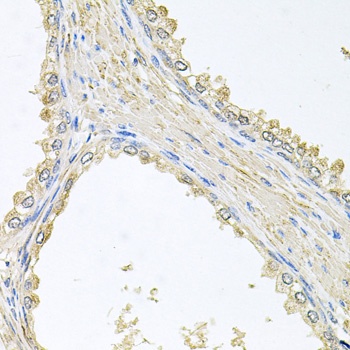 PMM2 Antibody