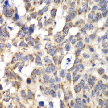 PARN Antibody