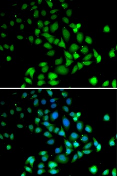 PARN Antibody