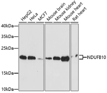 NDUFB10 Antibody