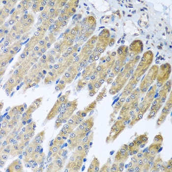 NDUFB10 Antibody