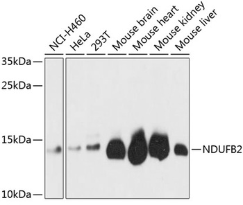 NDUFB2 Antibody