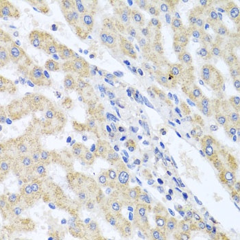 ITPKB Antibody